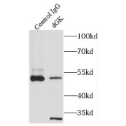 IP analysis of mouse kidney tissue lysate (4000 µg), using dGK antibody (3 µg, detection: 1/300 dilution).