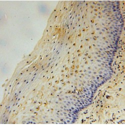 Diacylglycerol Kinase Theta (DGKQ) Antibody