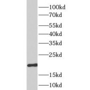WB analysis of K-562 cells, using DHFR antibody (1/500 dilution).