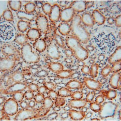 Dehydrogenase/Reductase SDR Family Member 1 (DHRS1) Antibody