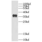 WB analysis of COLO 320 cells, using DHRS1 antibody (1/800 dilution).