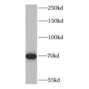 WB analysis of mouse kidney tissue, using DHX35 antibody (1/300 dilution).