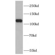 WB analysis of human brain tissue, using DHX36 antibody (1/800 dilution).
