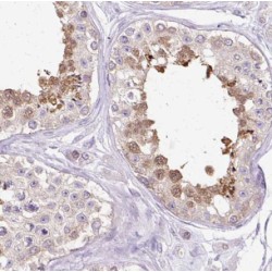 DEAH (Asp-Glu-Ala-Asp/His) Box Polypeptide 57 (DHX57) Antibody