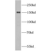 WB analysis of HeLa cells, using DHX57 antibody (1/1000 dilution).