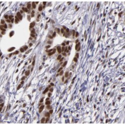 Exosome Complex Exonuclease DIS3 (DIS3) Antibody