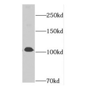 WB analysis of HeLa cells, using DIS3 antibody (1/500 dilution).