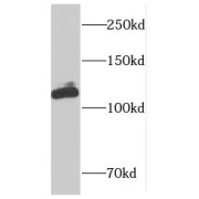 WB analysis of K-562 cells, using DIS3L antibody (1/100 dilution).