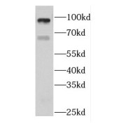 WB analysis of HepG2 cells, using DIS3L2 antibody (1/600 dilution).