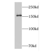 WB analysis of HeLa cells, using DISP1 antibody (1/1500 dilution).