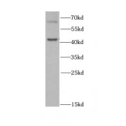 WB analysis of mouse testis tissue, using DKC1 antibody (1/1000 dilution).