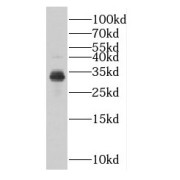 WB analysis of human placenta tissue, using DKK1 antibody (1/500 dilution).