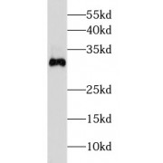 WB analysis of mouse skeletal muscle tissue, using DKK2 antibody (1/500 dilution).