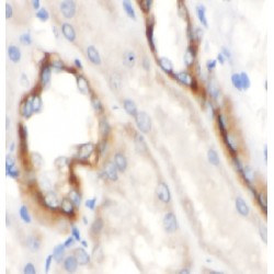 Dihydrolipoyl Transacetylase (DLAT) Antibody