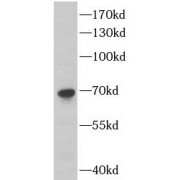 WB analysis of HepG2 cells, using DLAT antibody (1/2000 dilution).