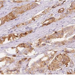 Deleted In Lymphocytic Leukemia 1 (DLEU1) Antibody