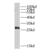 WB analysis of K-562 cells, using DLEU1 antibody (1/500 dilution).