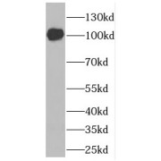 WB analysis of mouse brain tissue, using DLG3 antibody (1/1000 dilution).