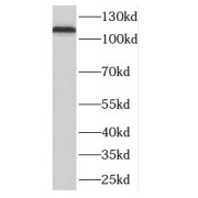 WB analysis of human brain tissue, using DLGAP3 antibody (1/500 dilution).