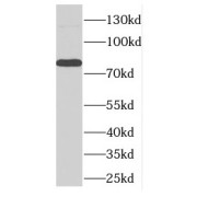 WB analysis of mouse brain tissue, using DLL4 antibody (1/300 dilution).