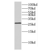 WB analysis of human brain tissue, using DLX1 antibody (1/300 dilution).