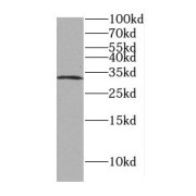 WB analysis of mouse lung tissue, using DLX3 antibody (1/1000 dilution).