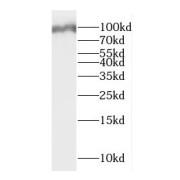 WB analysis of mouse liver tissue, using DMGDH antibody (1/3000 dilution).