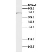 WB analysis of mouse ovary tissue, using DMKN antibody (1/500 dilution).