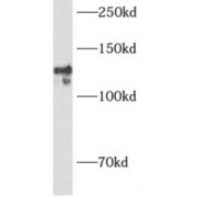 WB analysis of mouse thymus tissue, using DNA2 antibody (1/500 dilution).