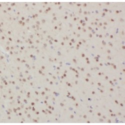 Dynein Intermediate Chain 2, Axonemal (DNAI2) Antibody