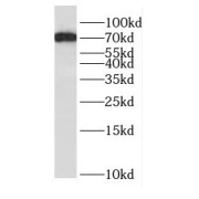 WB analysis of mouse lung tissue, using DNAI2 antibody (1/400 dilution).