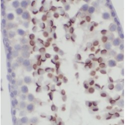 DnaJ (Hsp40) Homolog, Subfamily B, Member 13 (DNAJB13) Antibody