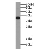 WB analysis of K-562 cells, using DNAJB2 antibody (1/300 dilution).