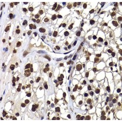 DnaJ (Hsp40) Homolog, Subfamily B, Member 6 (DNAJB6) Antibody