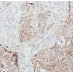 DnaJ (Hsp40) Homolog, Subfamily C, Member 1 (DNAJC1) Antibody