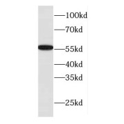 WB analysis of Jurkat cells, using DNAJC7 antibody (1/500 dilution).