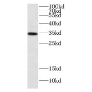 WB analysis of mouse testis, using DNALI1 antibody (1/5000 dilution).