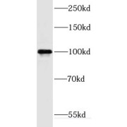 WB analysis of HL-60 cells, using DNM2 antibody (1/500 dilution).