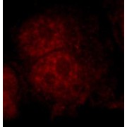 IF analysis of HepG2 cells, using DNMT1 antibody (1/25 dilution) and Rhodamine-Goat anti-Rabbit IgG.