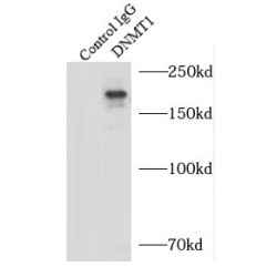 DNA Methyltransferase 1 (DNMT1) Antibody