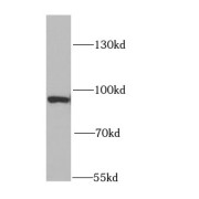 WB analysis of mouse brain tissue, using DNMT3A antibody (1/1000 dilution).