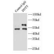 IP analysis of Raji cell lysate (2000 µg), using DNTT,TDT antibody (4 µg, detection: 1/300 dilution).