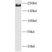 WB analysis of A549 cells, using DOCK8 antibody (1/800 dilution).