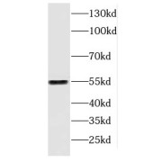 WB analysis of Jurkat cells, using DOK2 antibody (1/1000 dilution).