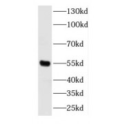 WB analysis of Jurkat cells, using DOK3 antibody (1/800 dilution).