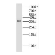 WB analysis of mouse liver tissue, using DOK5 antibody (1/300 dilution).