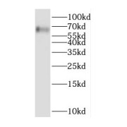 WB analysis of Jurkat cells, using DOK7 antibody (1/1000 dilution).