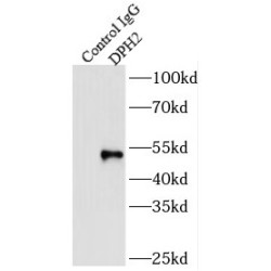 Diphthamide Biosynthesis Protein 2 (DPH2) Antibody