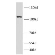 WB analysis of PC-3 cells, using DPP4 antibody (1/500 dilution).