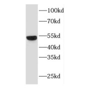 WB analysis of mouse skeletal muscle tissue, using DPP7 antibody (1/300 dilution).